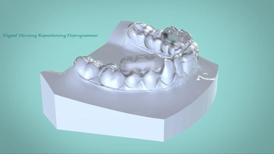 digitale mattina riposizionamento deprogrammer scienza 3shape medico la stampa 3d scansione cad dental tecnologia keyshot stecca denti 3dscanners rami labmagic3d altri 3d print model - Mito3D
