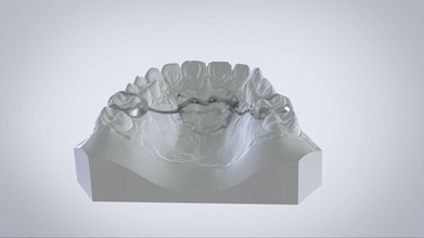digital nance holder appliance science orthodontics cad 3shape labmagic 3d caddent keyshot other 3d print model - Mito3D