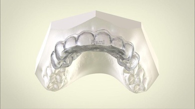 digitale ortho mini deprogrammer stecca scienza dental l'odontoiatria ortodonzia cad stomatolog altri 3d print model - Mito3D