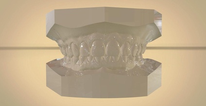 digital orthodontic study models virtual abo bases science dental 3d cad orthodontic 3shape keyshot render medical dentistry science other
