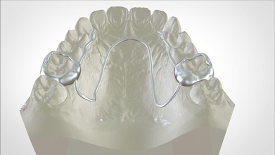 dijital porter cihaz bilim tıp 3d CAD / CAM sls sla stl diş hekimliği hekimi tıbbi baskı ortho 3shape keyshot rhino3d diğer 3d print model - Mito3D