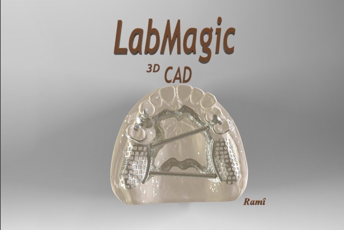 digital removable partial denture 3d scanned scannedmodel cad dental rpd 3dscanner tooth dentist science dentistry 3D print model - Mito3D
