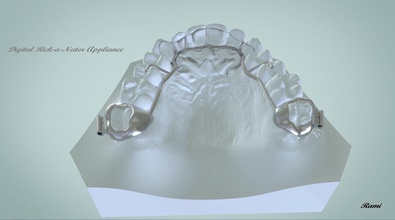 digital rickanator utensílio 3d dente 3shape magia laboratório 3dcad ramos eletrodomésticos talas ortodontia dentaduras dental ciência odontologia cúspide 3d print model - Mito3D