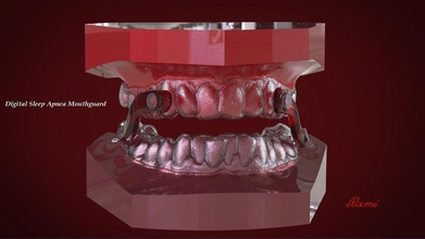 digitale dormire apnea paradenti medico medicina sonno 3shape keyshot rami dente protesi dental3d 3d cad cadcam 3dprinting scienza 3d print model - Mito3D