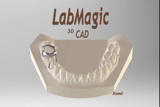 digital space maintainer appliance science orthodontics dental canine molar premolar bicuspid incisor dentine mouth scanned scannedmodels models 3d laser scanners other 3d print model - Mito3D