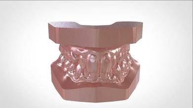 digital-Studie Kieferorthopädie archman-Modelle Wissenschaft die dental Zahnmedizin hygiene 3d 3dprint cnc cad rami bedruckbar ist dental3d 3shape keyshot medizinische andere 3d print model - Mito3D