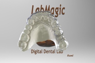 digital quirúrgico guía rail dental guiado odontología canalla diente dientes medicamento implantologia 3shape entablillar straumann ciencias 3d print model - Mito3D