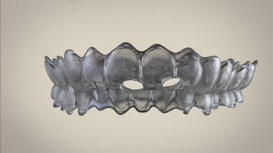 numérique dent positionneur dentaire goujat orthodontie 3d 3dprinter stl science 3shape rhinocéros rendre dentisterie dentiste 3d print model - Mito3D