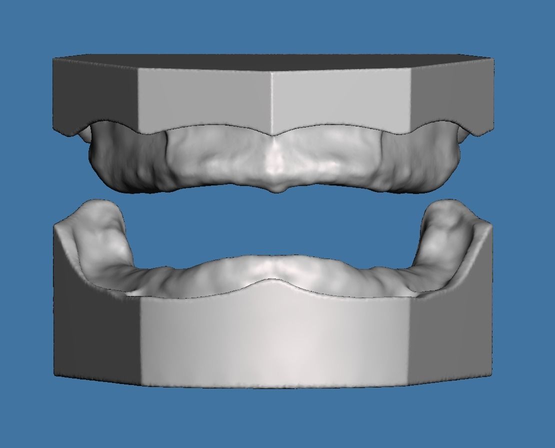 edentulous scan model maxillary mandibular dental dentist denture fulldenture teeth tooth mouth toothbrush science care biology 3D print model - Mito3D