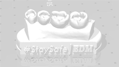 edm dentaire entraine exclusif modèle classe 1 2 dentiste émail dents dent dentisterie précédent composite molaire dentition bouche canine canin incisif anatomie science 3d print model - Mito3D