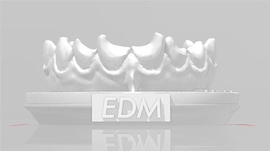 edm dental practice exclusive model class 4 central dentist enamel teeth tooth dentistry anterior composite molar dentition mouth cuspid canine incisive anatomy science 3d print model - Mito3D