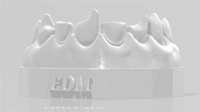 edm dental practice exclusive model class 4 direct veneer dentist enamel teeth tooth dentistry anterior composite molar dentition mouth cuspid canine incisive anatomy science 3d print model - Mito3D