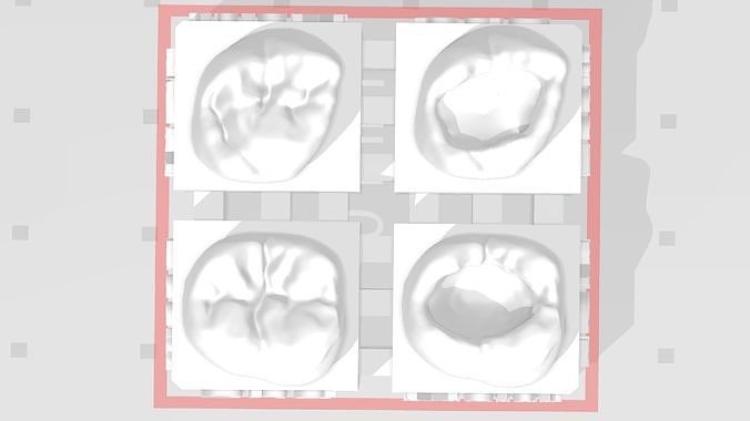 edm dentale pratica alto anatomia messa fuoco 2nd molare dentista smalto denti dente odontoiatria precedente composito dentizione bocca cuspide canino incisivo scienza 3D print model - Mito3D