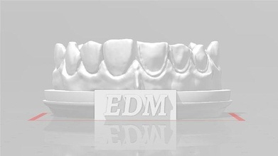 edm dental practice higher quality model direct veneer dentist enamel teeth tooth dentistry anterior composite molar dentition mouth cuspid canine incisive anatomy science 3d print model - Mito3D