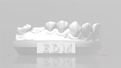 edm dental practice model crown class 1 dentist enamel teeth tooth dentistry anterior composite molar dentition mouth cuspid canine incisive anatomy science 3d print model - Mito3D