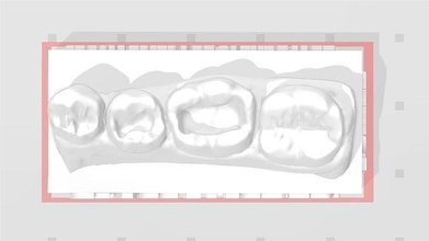 erozyon diş uygulama model standart sınıf 1 doktoru emaye hekimliği önceki bileşik azı dişi dişlenme ağız kuspid köpek keskin anatomi bilim 3d print model - Mito3D