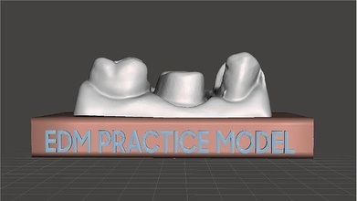 edm dental practice standard model class 2 bridge dentistry molar crown mouth dentist teeth composite training art anatomy science 3d print model - Mito3D
