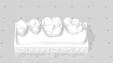 edm Dental trainieren Standard Oberer höher Modell Klasse 1 Zahnarzt Zahnheilkunde Wissenschaft medizinisch Molar Schneidezahn Kieferorthopäde 3d print model - Mito3D