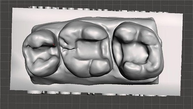 edm dental trainieren standard oberer höher modell klasse 2 m1 m2 p2 zahnarzt emaille zähne zahn zahnheilkunde bisherige zusammengesetzt molar dentition mund eckzahn scharfsinnig wissenschaft 3d print model - Mito3D