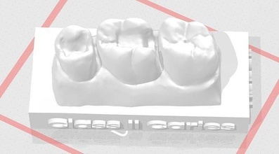 edm dental práctica estándar superior modelo clase 2 muestra dientes esmalte diente dentista cepillo anatomía molar dentina boca dentición ciencias 3d print model - Mito3D