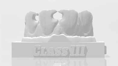 edm dental practice standard upper model class 3 dentist enamel teeth tooth dentistry anterior composite molar dentition mouth cuspid canine incisive science 3d print model - Mito3D