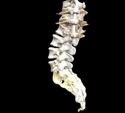 femmina spina dorsale di installazione scienza sesso femminile colonna vertebrale la medicina ricostruzione biologia 3d print model - Mito3D