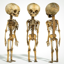 feto 3d imprimible humano nacido impresión cuerpo esqueleto ciencias biología cráneo personas bebé huesos hueso cofre pierna brazo mano pie columna vertebral 3d print model - Mito3D