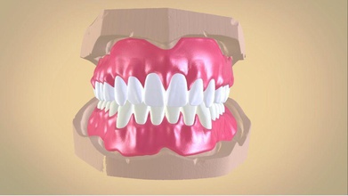dentaduras produção opções dental utensílio dentista tecnologia dentária odontologia ciência 3d 3shape estereolitografia frente onda gengiva dentadura 3dscanned 3d print model - Mito3D
