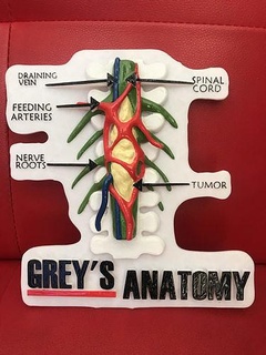 grises anatomía tumor 3d imprimible Anatomía Grey serie gris Arte señales logos 3d print model - Mito3D
