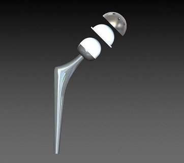 hip prosthesis medical foot leg design science astronomy physics 3d print model - Mito3D