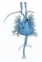 aorta herz kammern 3d drucken highpoly biologie anatomisch ct scan wissenschaft 3d print model - Mito3D