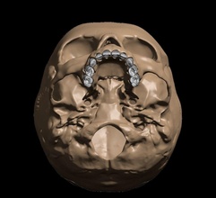 umano bambino cranio anatomia modello individuale denti osso dentale dentista tecnologia scienza biologia 3d print model - Mito3D