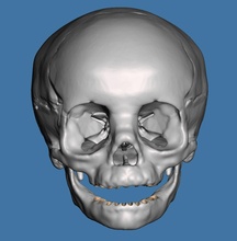 insan çocuk kafatası anatomi model no diş ağız çene doktoru hekimliği iskelet kemik birincil süt dişi bilim biyoloji 3d print model - Mito3D