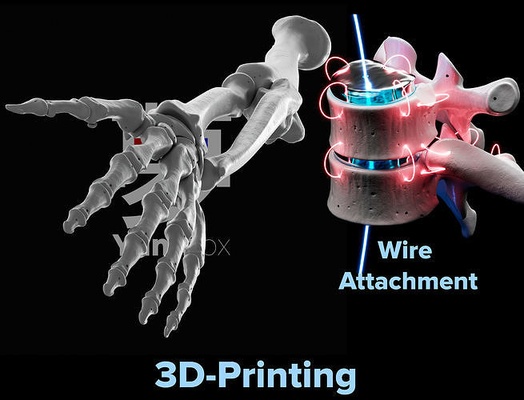 lt arm hand knochen anatomie skelett medizinisch wissenschaft halloween charakter anatomisch grusel biologie 3d drucken 3dprinting drucken 3d print model - Mito3D