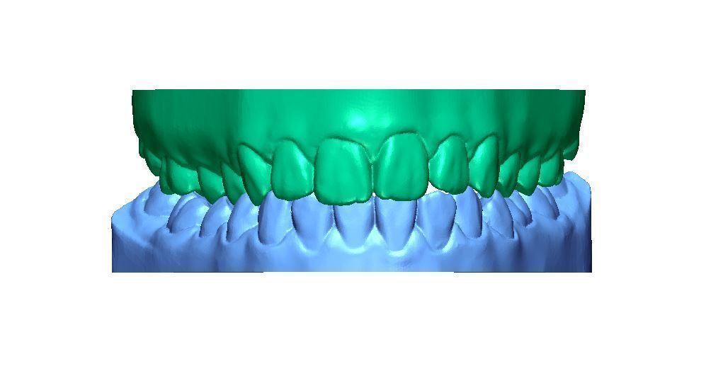 humano dientes base mandil maxilar superior impresión 3dlaser médico modelo ciencias biología 3D print model - Mito3D