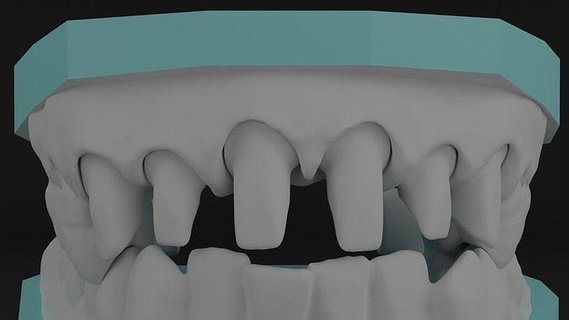 insan diş restorasyon takma fırçası doktoru ilaç hekimliği bakım çökmek kök setofteeth vücut anatomi Bilim tıbbi karakter Biyoloji 3d print model - Mito3D