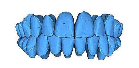 i denti umani scienza umana mandile mascella impressione 3dlaser medico modello biologia 3d print model - Mito3D
