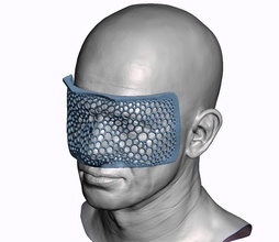 impression plateau visage faciale prothèse maxillo anaplastologie silicone orbital nez science biologie 3d print model - Mito3D