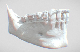 mandíbula felipe lopes machado medicamento odontologia dentes dente mar saúde biologia natureza Ciência 3d print model - Mito3D