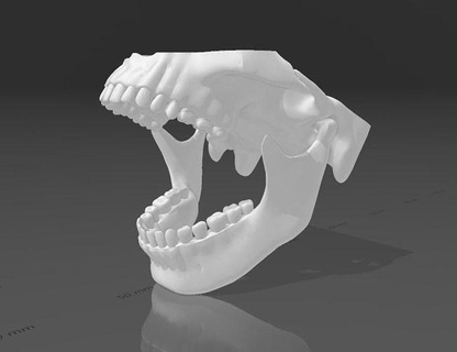 mandibula articulada - articulated jaw teeth dentistry anatomy tooth bone dental health science mouth dentist medicine human implant implanted medical molar prosthesis biology 3d print model - Mito3D