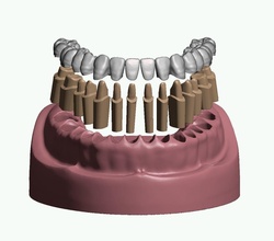 mandibular dental model prepped dies crowns teeth anatomy mouth jaw dentist dentistry gum enamel science biology 3d print model - Mito3D