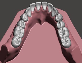 mandibular dental modelo dientes anatomía ciencias medicamento odontología tipodonto tallado biología 3d print model - Mito3D