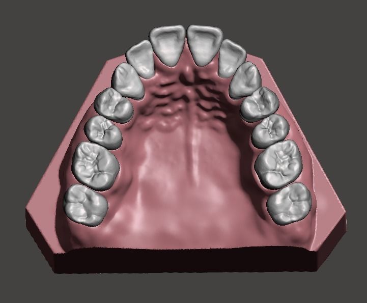 maxillary dental model dentist teeth medicine science biology 3D print model - Mito3D