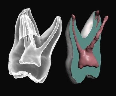 maxilar molar polpa anatomia dente dental odontologia canal raiz boca Ciência biologia 3d print model - Mito3D