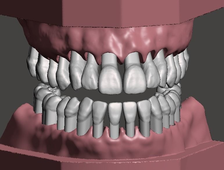 maxillary mandibular dental models tooth teeth anatomy mouth dentistry science biology 3D print model - Mito3D