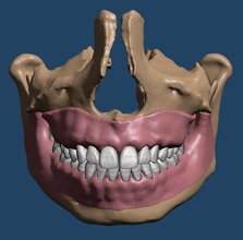 maksiller çene diş modeller anatomik kemik anatomi bilim kafatası hekimliği teknolojisi biyoloji 3d print model - Mito3D