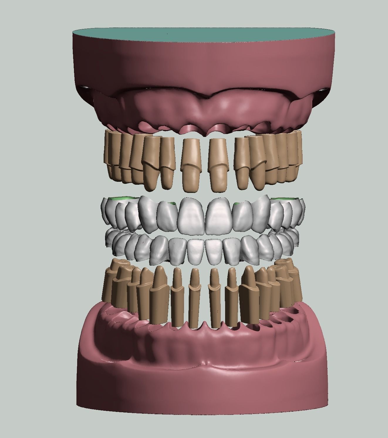 maxilar mandibular dental modelos coronas preparado muere anatomía dientes corona preparación diente odontología boca ciencias biología 3D print model - Mito3D
