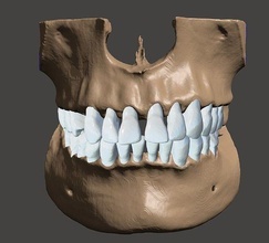 oberkiefer unterkiefer dental modelle anatomisch zähne medizin pflege emaille mund zahnarzt zahnheilkunde wissenschaft operation anatomie dentin molar dentition zahn zahnbürste dentalmodell biologie 3d print model - Mito3D