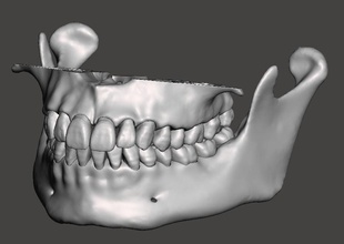 d012 mascellare mandibolare dentale modelli anatomico denti odontoiatria bocca anatomia mascella tecnologia scienza biologia 3d print model - Mito3D