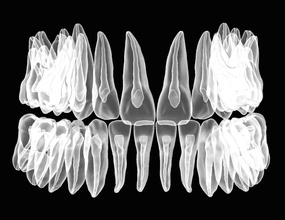 maxilar mandibular dientes pulpa odontología dental canal raíz anatomía natural oral boca medicamento mella dentina ciencias biología 3d print model - Mito3D